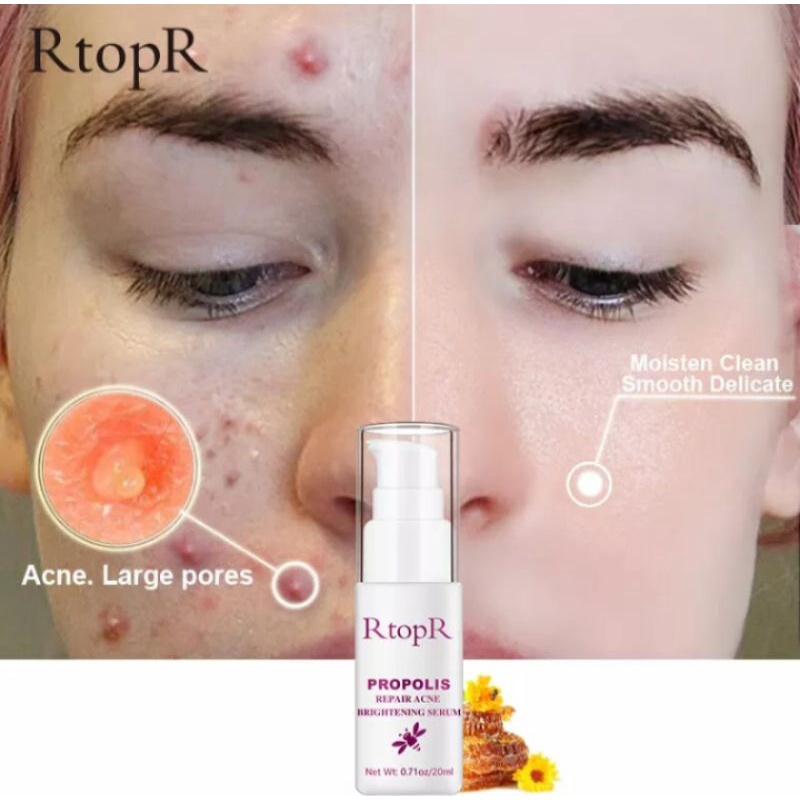 RtopR PROPOLIS REPAIR ACNE BRIGHTENING SERUM