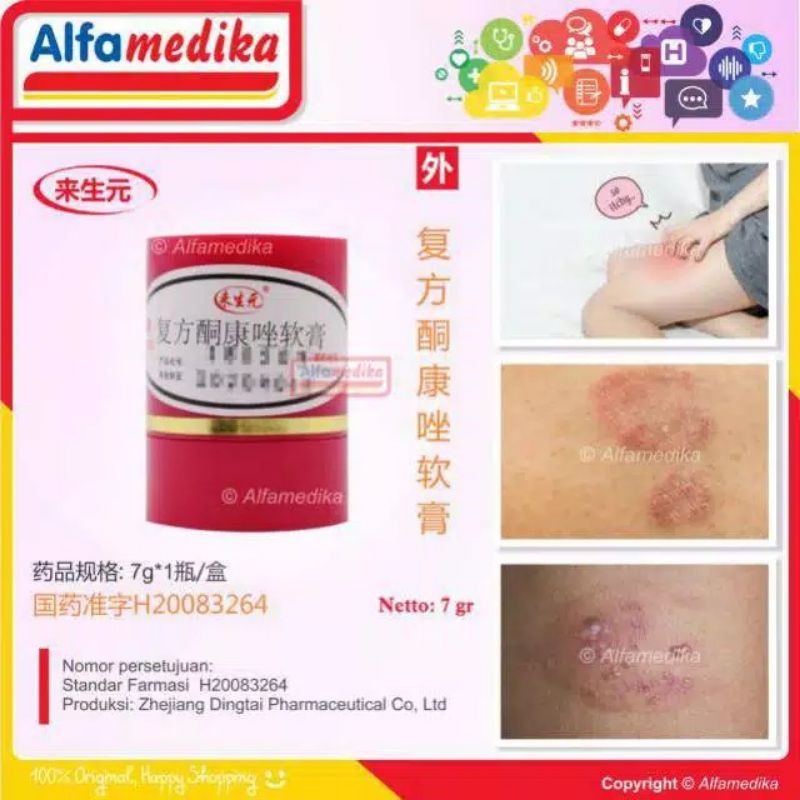 Salep / Cream Kulit Obat Gatal Cina Mengobati Panu Kadas Kudis Kurap Gudik Herpes Eksim Alergi