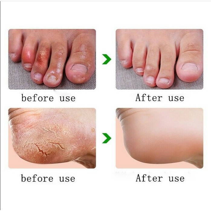 GOOD QUALITY Hand Foot Crack Cream Penghalus Tumit Pecah Pecah