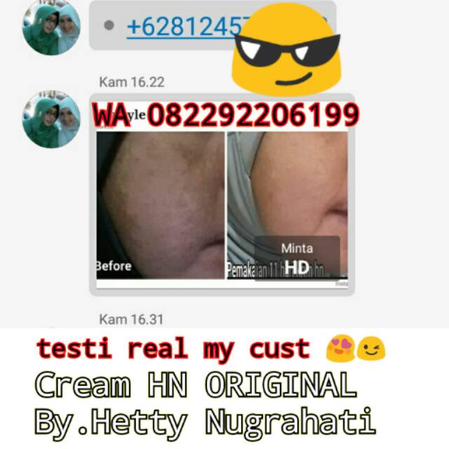 TESTIMONI REAL MY CUST CREAM HN ORIGINAL HETTY NUGRAHATI