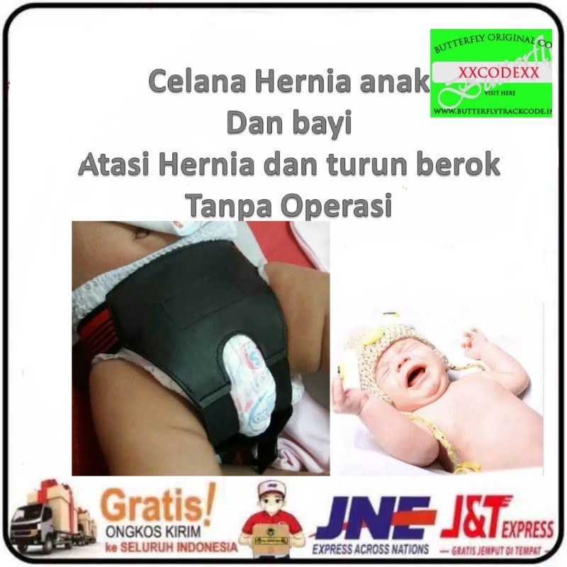 CELANA HERNIA BAYI | CELANA HERNIA ANAK