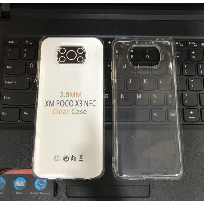 JELLY CASE SLIM XIAOMI POCO X3 NFC TRANSFARAN BENING ANTI JAMUR SILIKON