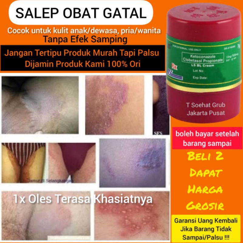 [COD] Obat Kulit Gatal Jamur Kurap Koreng Kudis Eksim Herpes Obat Gatal Selangkangan Paling Ampuh