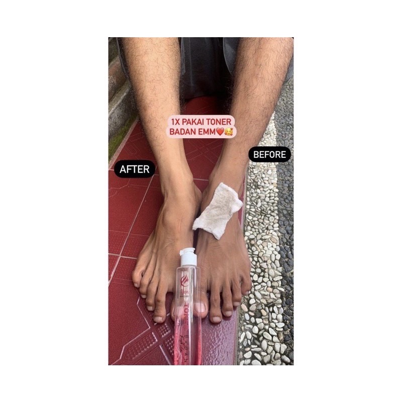TONER BADAN YONI SKINCARE 100 ml / Toner Badan HALAL &amp; BPOM (Pemutih Badan, Penghilang Bekas Luka)