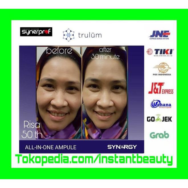 Krim Penghilang Keriput Wajah | Skincare Recomendasi Para Dokter Barang Berkualitas