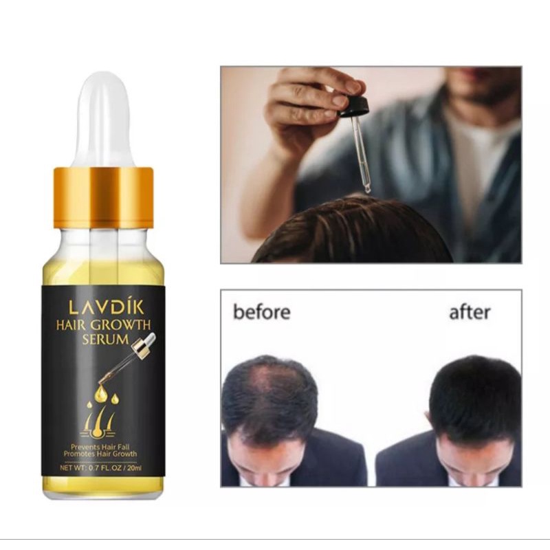 Serum Penambah Ketebalan Rambut Mengatasi Kerontokan Rambut LAVDIK