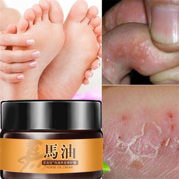 krim kaki pecah dan kering pemutih tangan dan kaki obat kaki pecah dan kering penghalus tumit kaki kaki pecah dan kering obat kaki pecah dan kering ampuh kaki pecah pecah pembersih tumit kaki pecah salep kaki pecah dan kering obat kaki pecah Memperbaiki