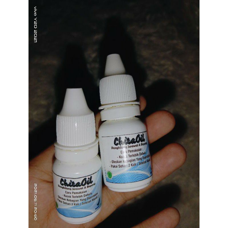 CHITA OIL PENGHILANG BEKAS LUKA/KOMEDO/FLEK HITAM