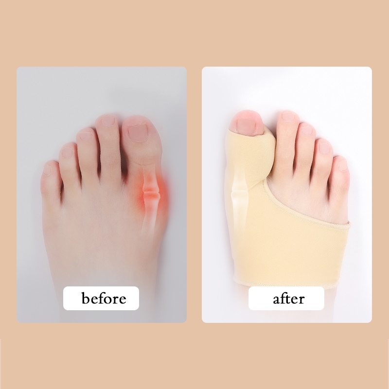 ★1 Pasang★ Korektor Tulang Jempol Bunion Hallux Orthotics Alat Corrector Bunion Hallux Orthotic Bunion Gel Socks Alat Korektor Jempol