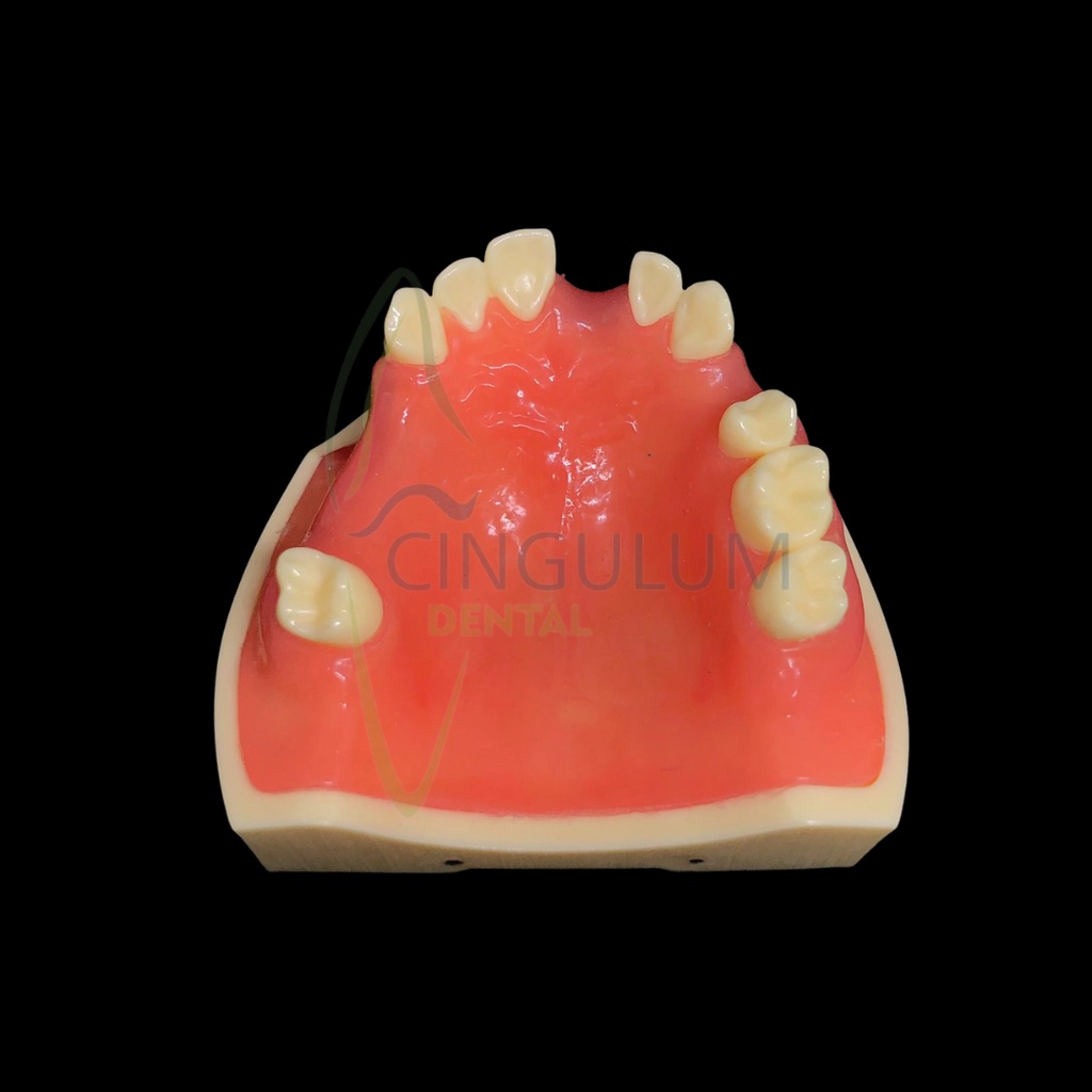 Model implan gigi / dental implant model