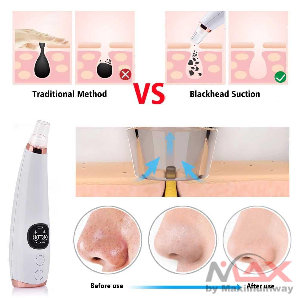 Hailicare vakum komedo penghisap komedo dan jerawat Vacuum Suction Skin Face Care Blackhead Pore Cleaner MC-004 Warna Putih Blackhead Remover Vacuum Acne Pimple Black Spot Suction Electric Facial Pore Cleaner Skincare Exfoliating Beauty Instrument