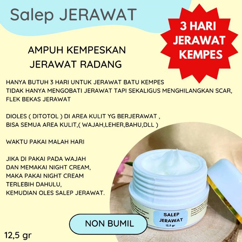 salep jerawat radang salep jerawat batu obat jerawat bernanah rmk