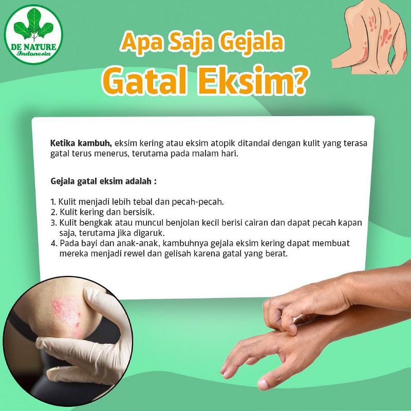 EXIMTAS EXCLEAR Obat Gatal Selangkangan Obat Kulit Gatal Jamur Bentol Merah Bersisik Obat Eksim Gatel Alergi Kurap Salep Gatal Menahun Alergi Kulit Scabies  Salep Kudis Obat Loang Obat Untuk Atasi Gatal Di Leher di Lengan Bintik Bintik Merah Asli DeNature-3
