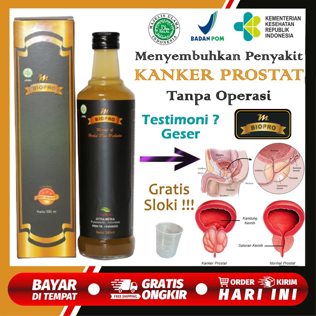 Obat Prostat dan Wasir Herbal Alami Bisa Cod - Obat Prostat Cina - MBIOPRO Herbal