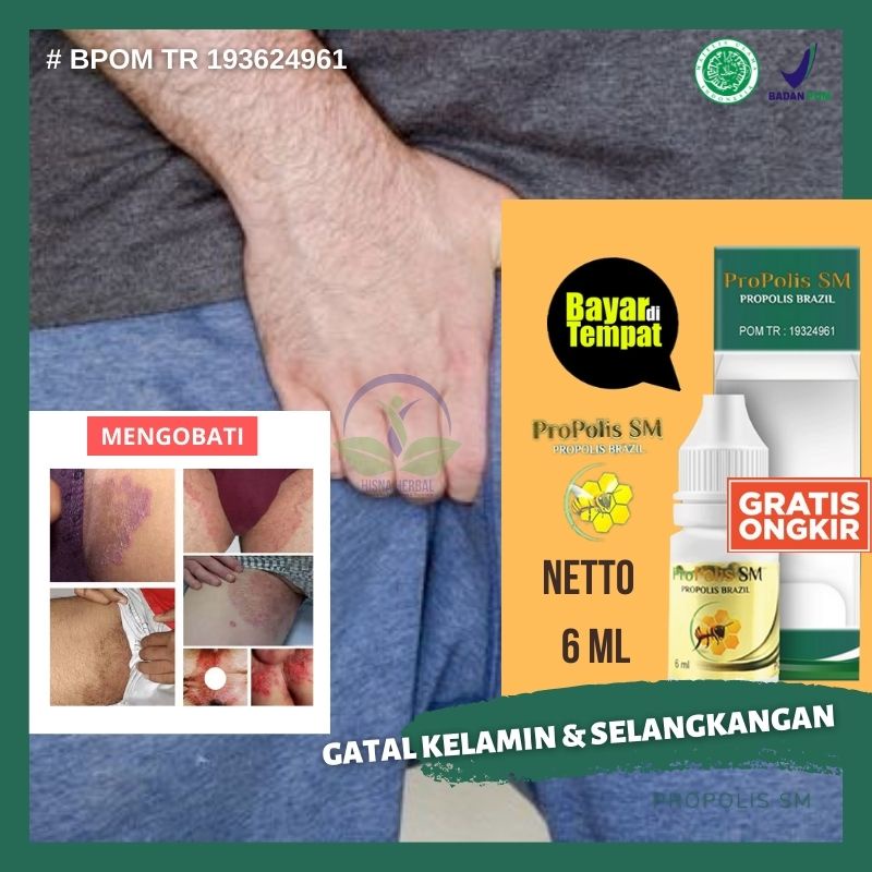 Obat Gatal Di Selangkangan Ada Bentol Banyak Infeksi Jamur Kutu Kemaluan Dermatitis Psoriasis Panu Shopee Indonesia