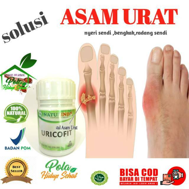 

OBAT ASAM URAT - NYERI SENDI - BENGKAK - REMATIK