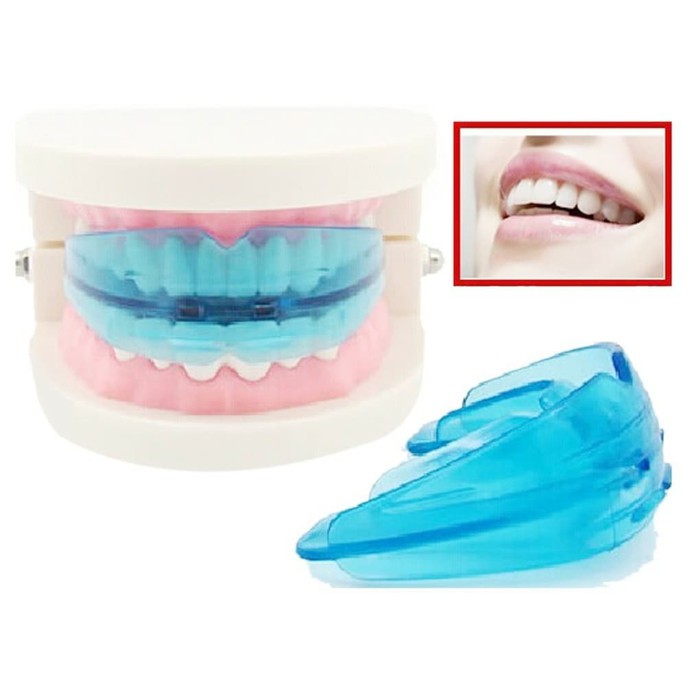 Alat Perapi Gigi Orthodontic Retainer Teeth Alignment Behel *SL10