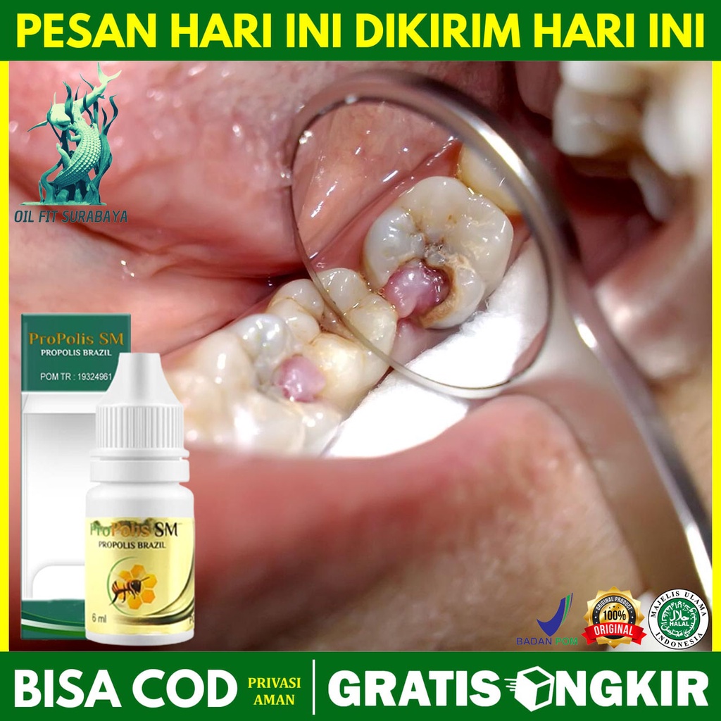 Obat Penghilang Daging Di Lubang Gigi Daging Jadi Gusi Tumbuh Di Lubang Penghancur Polip Gigi