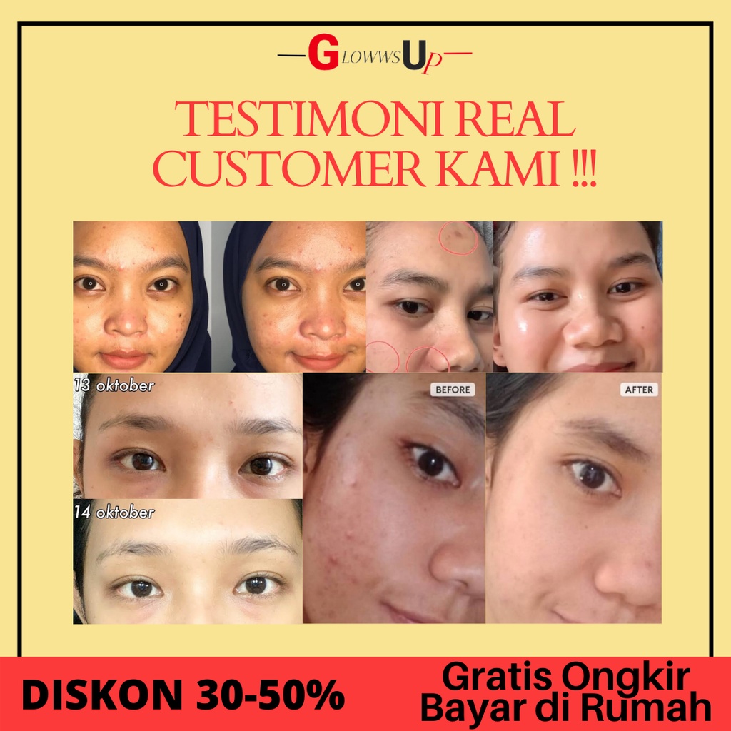 SERUM WAJAH GLOWING SOMETHINC SKIN DEFENDER BAKUCHIOL + COQ10m PERAWATAN WAJAH