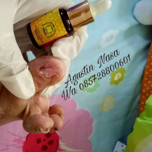 SUNPRO NASA / PROPOLIS / PROPOLIS NASA