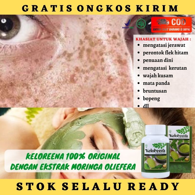 Obat Penghilang Flek Hitam di Wajah - Perontok Flek Hitam di Pipi - Obat Herbal Pembersih Noda Noda 