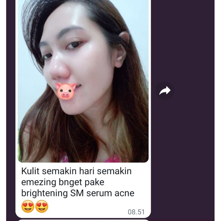 ORLIN/PAKET WHITENING PLATINUM/PAKET ORLIN/PAKET BRIGHTENING ORLIN/PEMUTIH WAJAH KULIT NOMAL/CREAM BPOM/SKINCARE BUMIL/SKINCARE BUSUI/ORLIN BEAUTY/BONUS GIFT-8