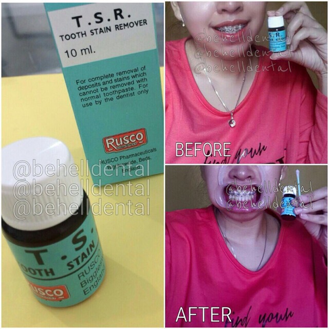 TSR ORI | PEMUTIH GIGI AMPUH PENGHILANG BAU MULUT PELUNAK KARANG GIGI BLEACHING WHITENING TEETH