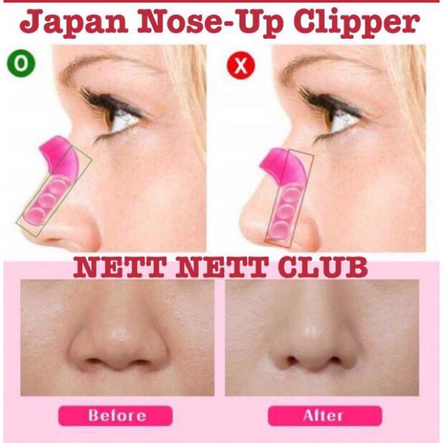 `ღ´ PHINKL `ღ´ Alat pemancung hidung Nose Up Cliper mancung tanpa operasi beauty tools kecantikan