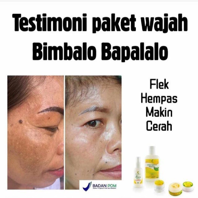 FaceCare/Skincare Bimbalo Bapalalo