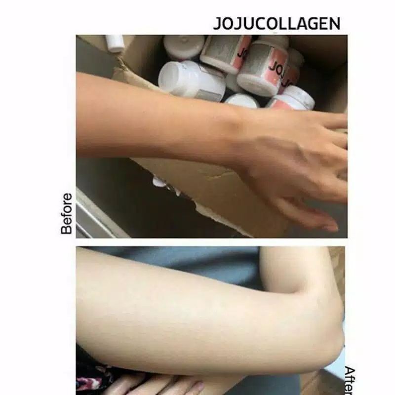 [RESELLER JABODETABEK RESMI] JOJU COLLAGEN DIJAMIN ORI 1000%
