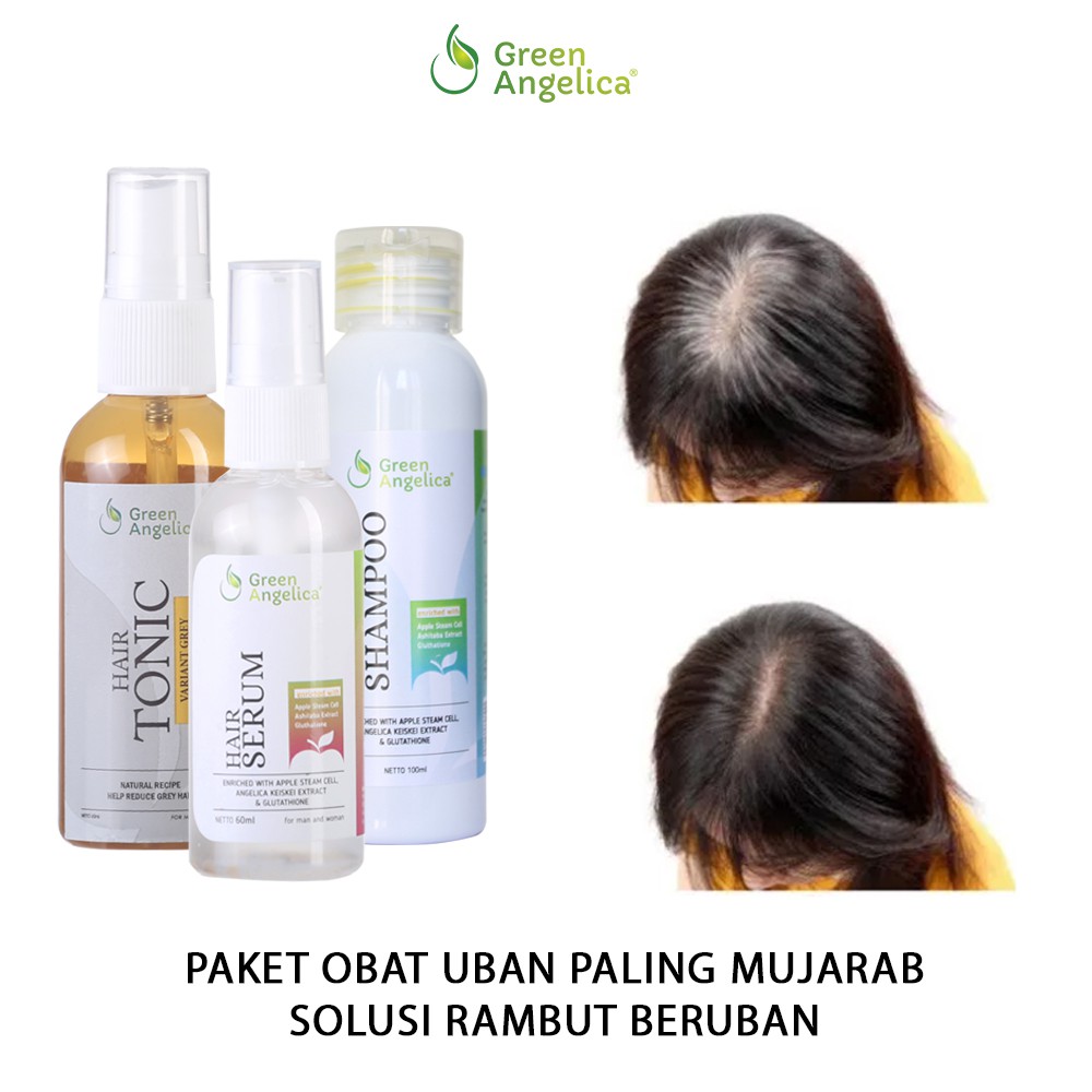 Paket Maksimal Penghilang Uban Green Angelica Penghitam Rambut Uban 100 Alami Shopee Indonesia