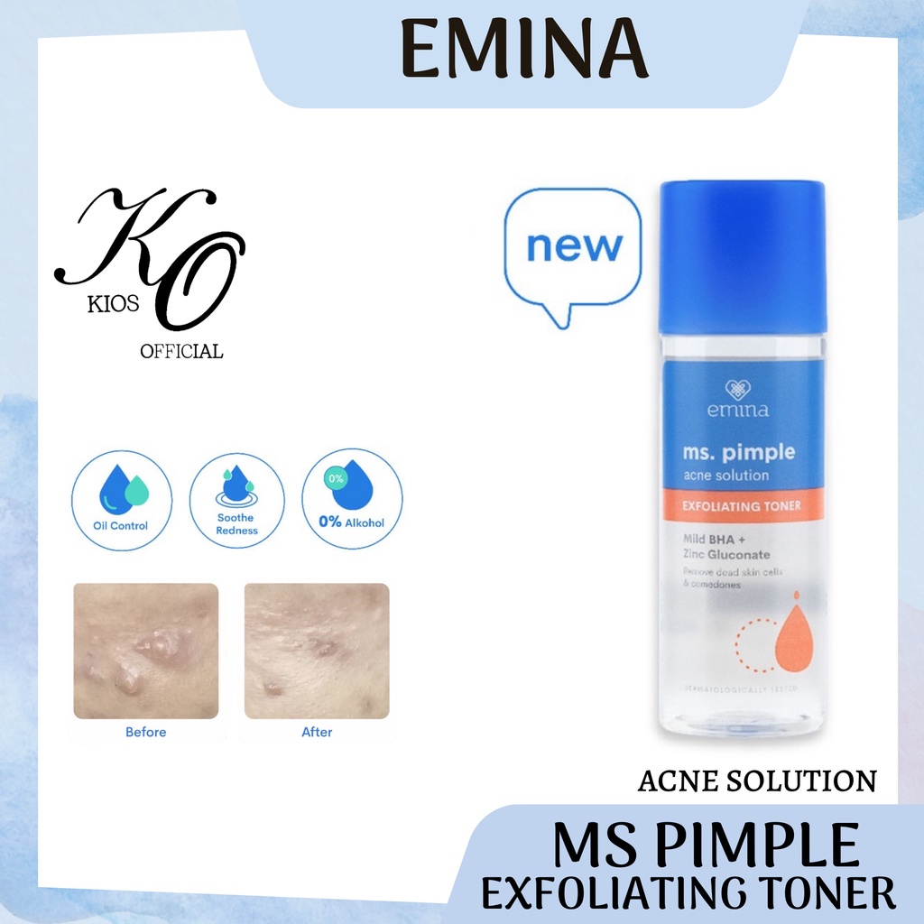 Emina Ms Pimple Acne Solution Series | Calming Gel | Exfoliating Toner | Face Serum | Face Toner | Face Wash | Moisturizing Gel | Spot Gel