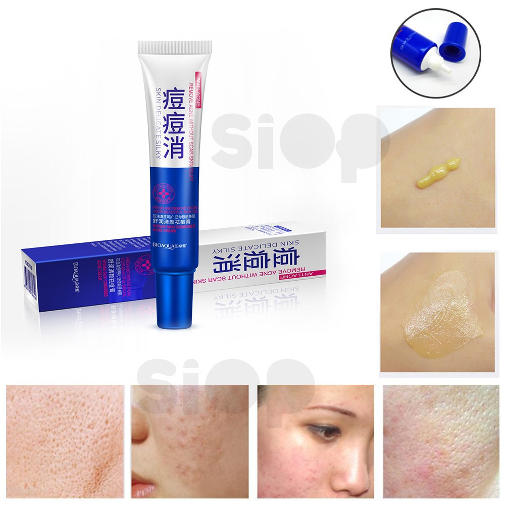 BIOAQUA Anti Acne -Oil Control- Acne Scar Remove Beauty Cream