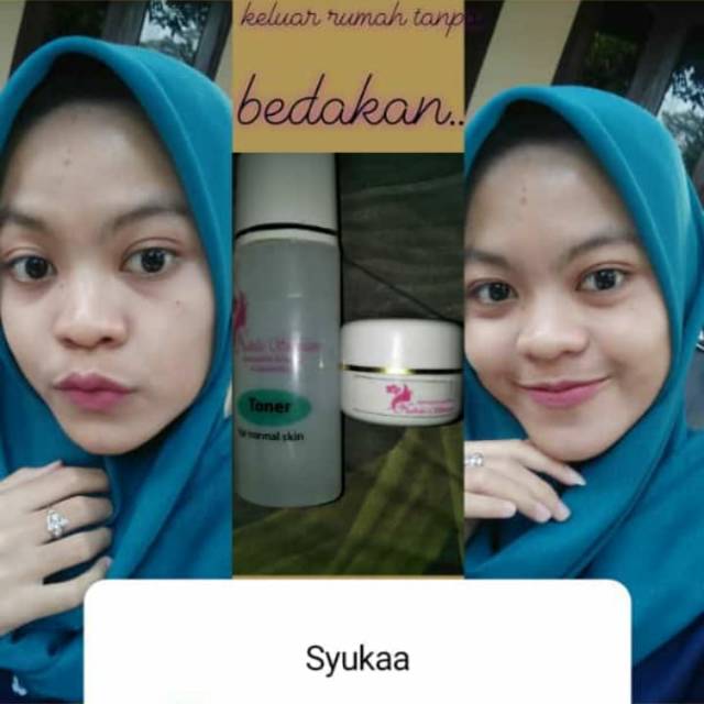 NADHA SKINCARE ACNE
