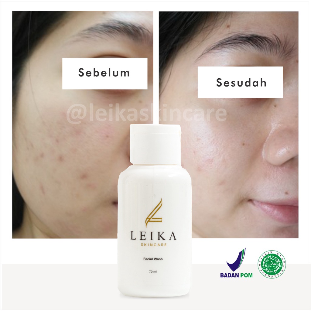 Sabun Wajah! Sabun Pelembab Kulit Wajah Kering Asli 100% BPOM Pelembab Wajah Kusam Berjerawat Jadi Putih Glowing Halal Facial Wash Leika Skincare  70ml Pelembab Wajah Resmi BPOM