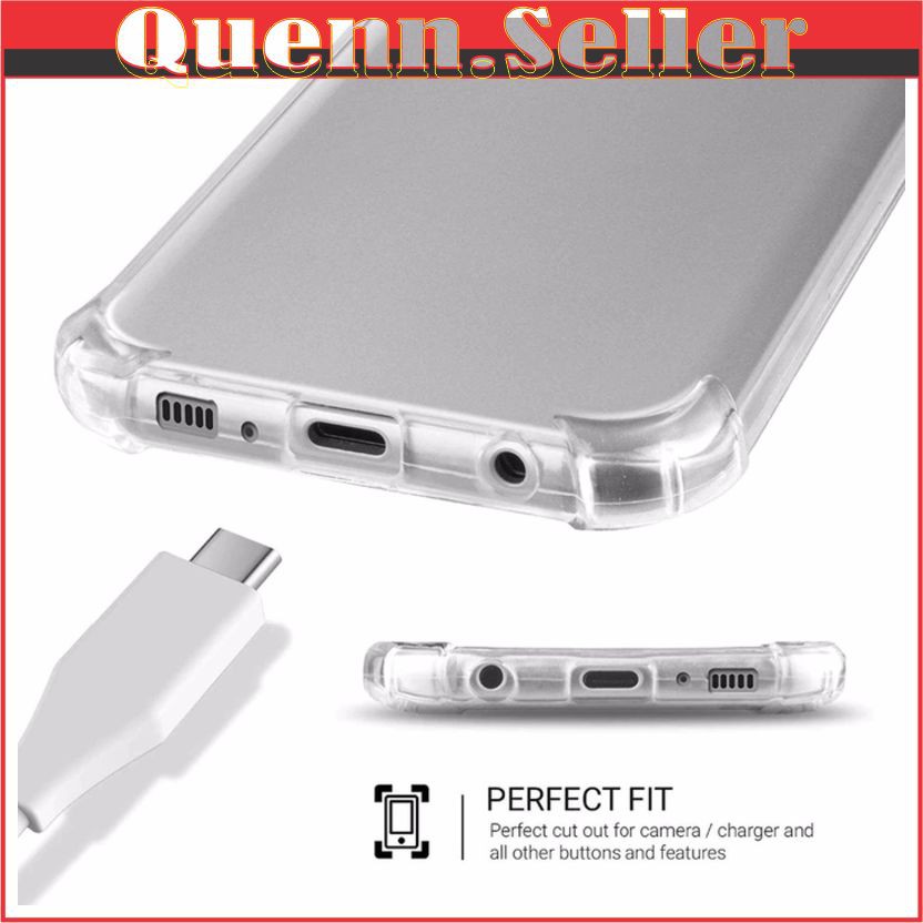 QS49 softcase kondom hp acc hp case hp casing hp Anticrack Mika Case Samsung J3 2016 J3 2017
