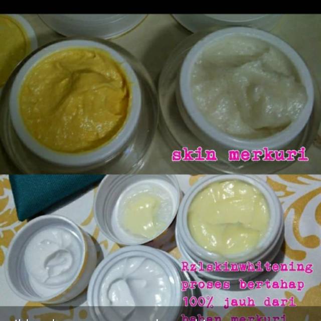 Cream jerawat RZL