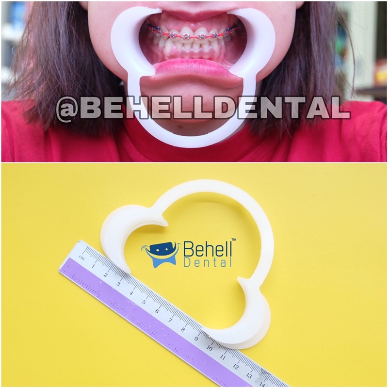 Behelldental PEMBUKA MULUT O MOUTHGATE CHECK RETRACTOR DEWASA SIZE M // PENYANGGA RAHANG GIGI BRACKET BEHEL // Alat Opener Bentuk C Saat pasang Behel Veneer Pemutih atau Bleaching Gigi