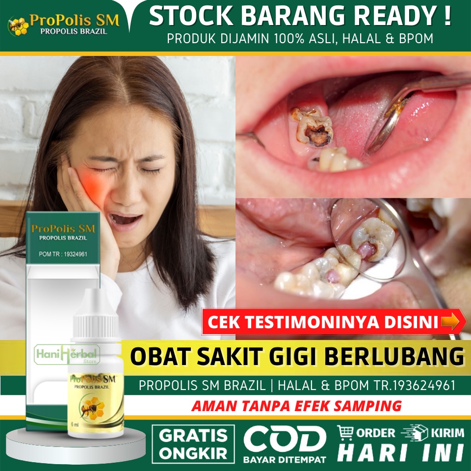 Obat Sakit Gigi Berlubang 100% Alami - Obat Sakit Gigi Untuk Anak & Dewasa - Obat Gusi Bengkak - Oba
