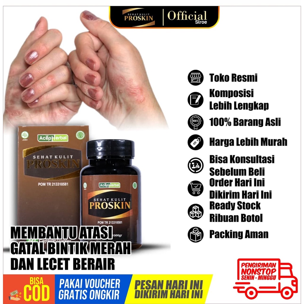 Proskin Suplemen Herbal Ekstrak Binahong Asli Obat Gatal Bintik Merah Dan Lecet Berair Isi 60 Kapsul