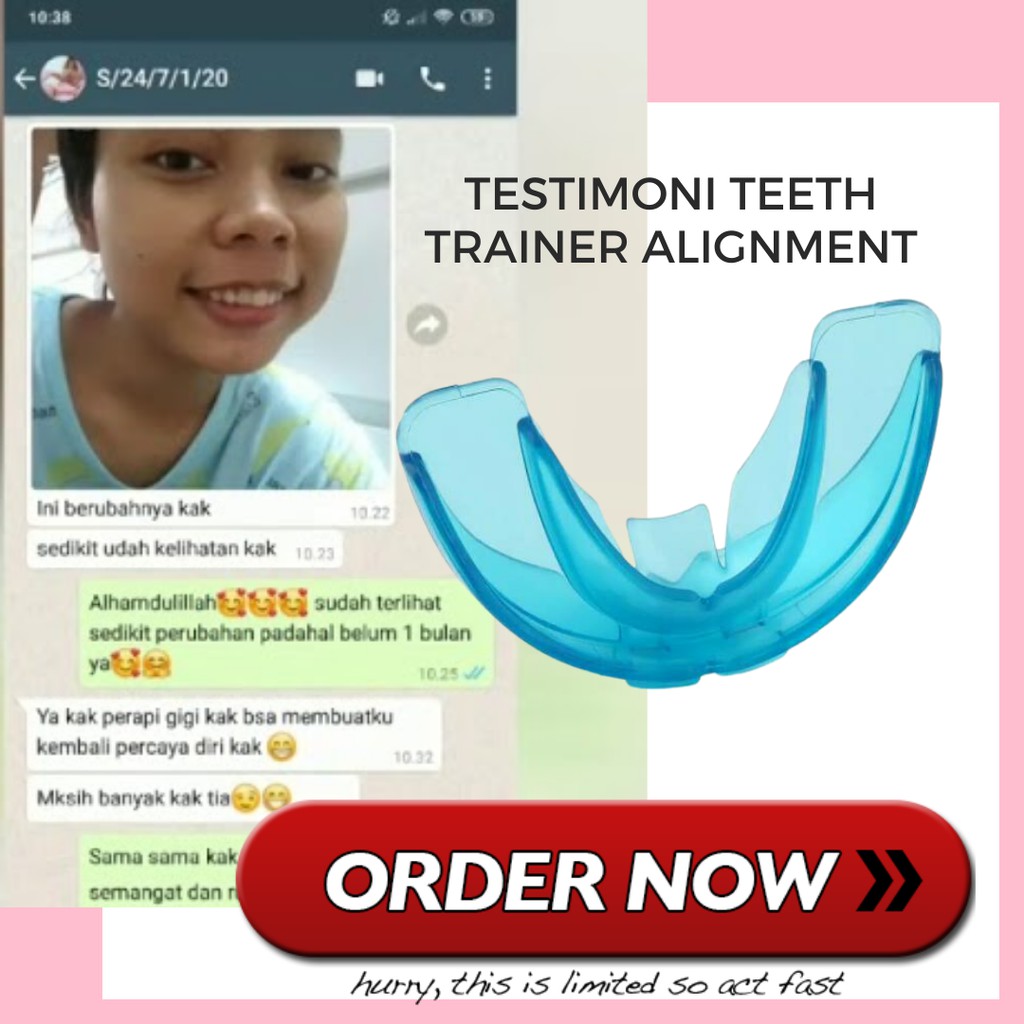 Behel Lepas Pasang Alat Perapi Gigi Retainer Perapih Gigi Tanpa Kawat Behel Teeth Trainer Alignment Perapih Gigi Anak Dan Dewasa Original