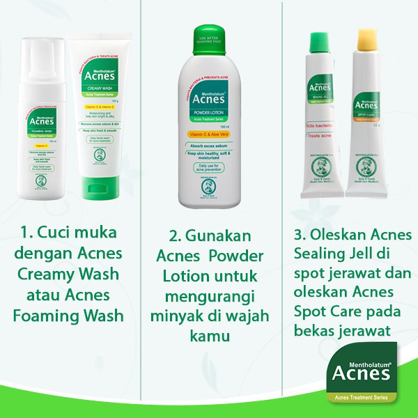 [BPOM] Acnes Oil Control Toner 110ml / Acnes Powder Lotion 100ml / Acnes Milk Cleanser 110ml / Acnes Natural Care / MY MOM