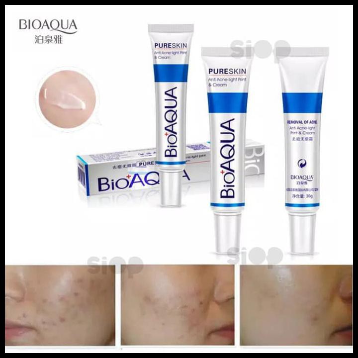 Original Bioaqua Pure Skin Removal Of Acne Cream Bioaqua Acne Rejuvenation Resmi Shopee Indonesia