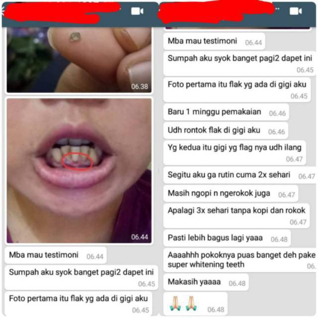 Pasta Gigi Pemutih Gigi Herbal Orecare Super Whitening Teeth Toothpaste Shopee Indonesia