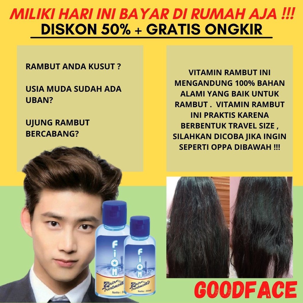 VITAMIN RAMBUT RONTOK - FION HAIR TREATMENT 30ML ORIGINAL BPOM - VITAMIN RAMBUT FION 30ML