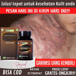 Jual Obat Eksim Kering Dan Basah, Salep Eksim Basah, Obat Eksim, Obat ...