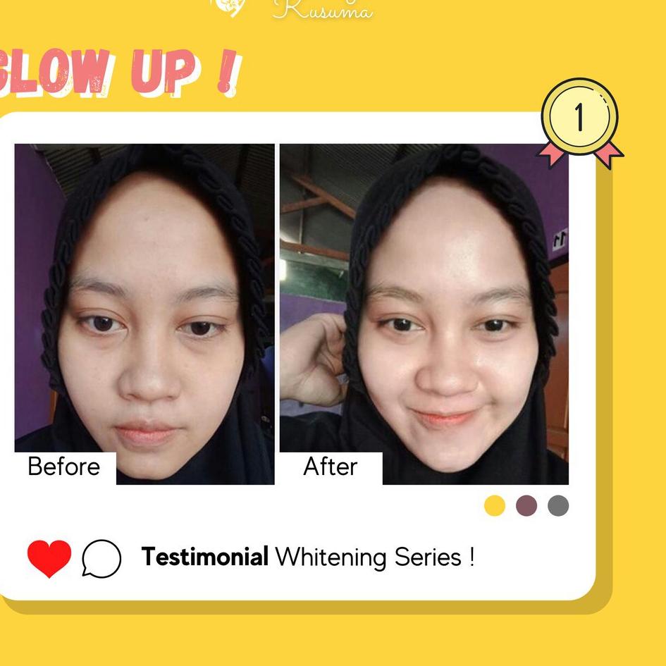 ▼ MS GLOW / MSGLOW / MS GLOW ORIGINAL / PAKET WHITENING MS GLOW / PAKET ACNE MS GLOW / PAKET LUMINOU