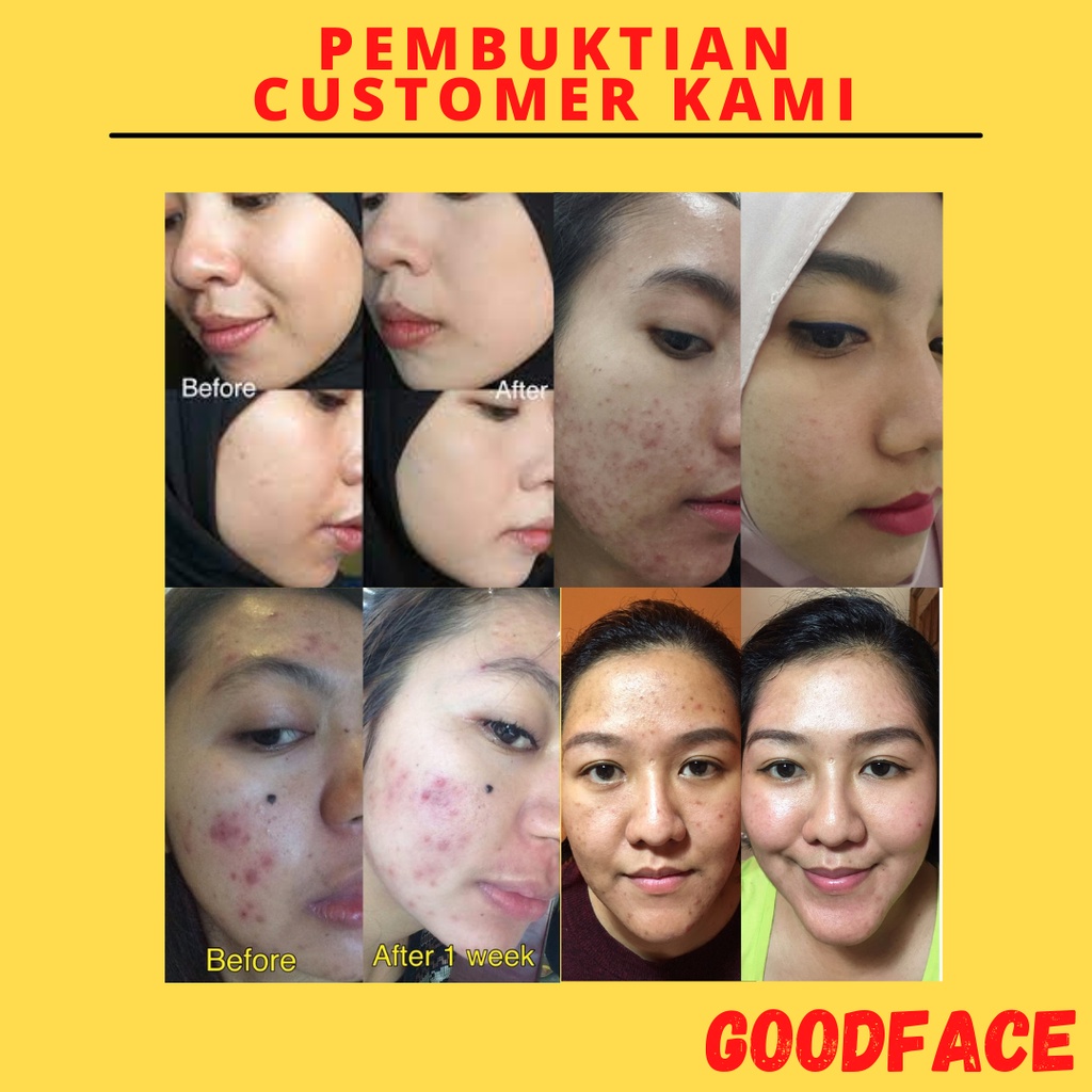 Serum Wajah - Pelembab Wajah BIOAQUA 24K Gold Facial Trial Kit (3g+3g+3g) ×10pcs