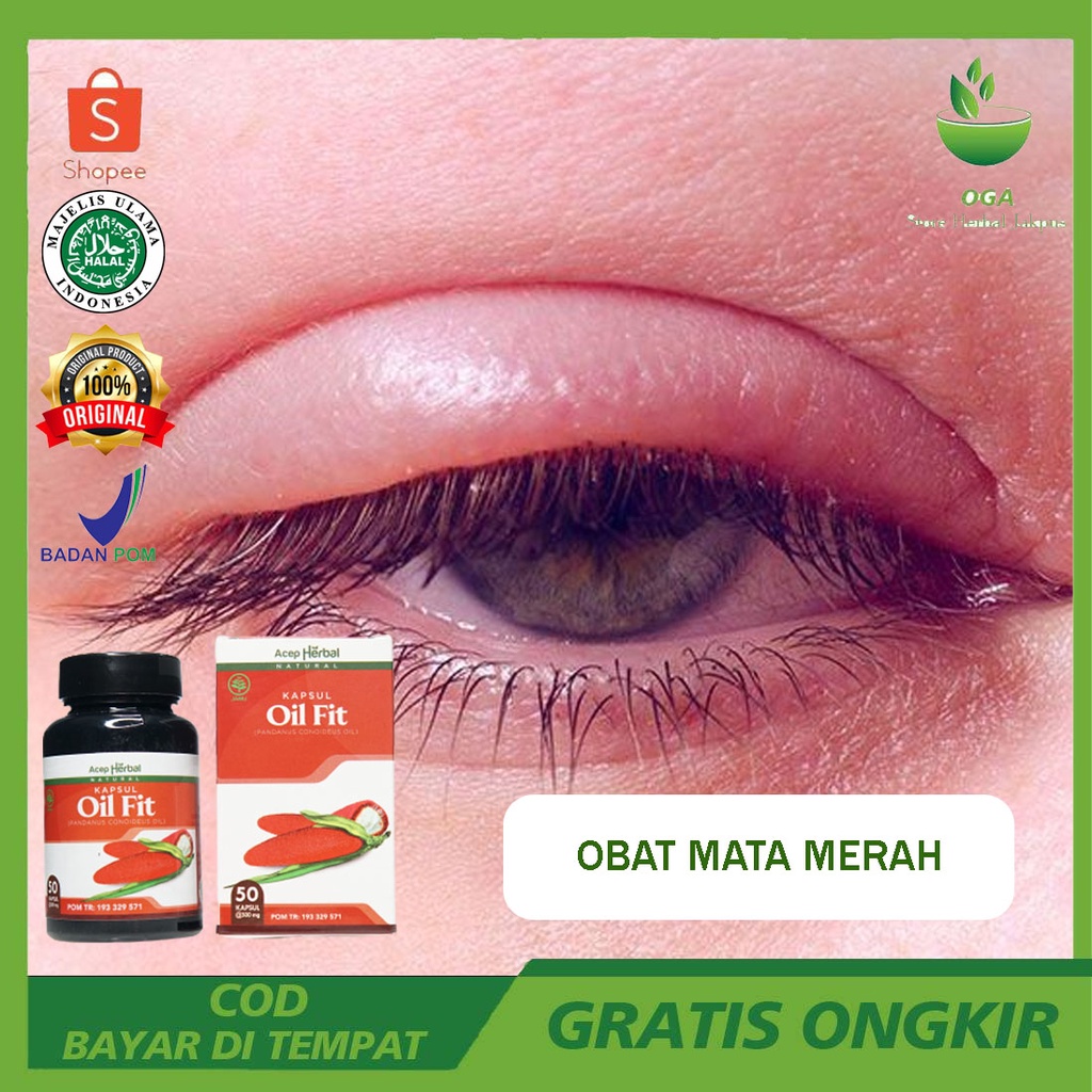 Obat Mata Merah Bengkak Bintitan Belekan Cendo Gatal Berair OIL FIT ORIGINAL BUAH MERAH PAPUA ASLI 1