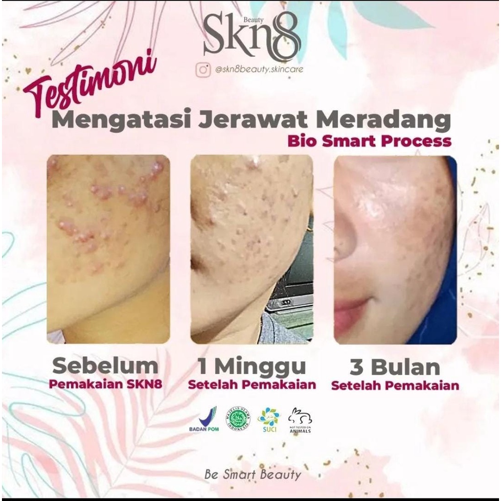 SKN8 Beauty Paket Skincare Lengkap Alami + Probiotik BPOM